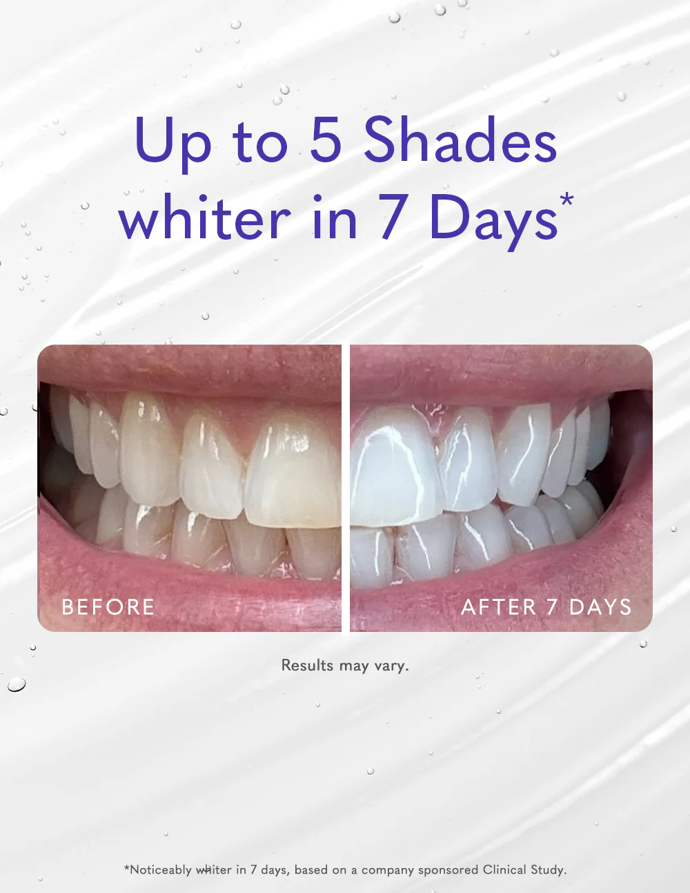 Pro Whitening Gel (Large) - Image 5